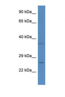 CHCHD6 Antibody - CHCHD6 antibody Western blot of Fetal Liver lysate. Antibody concentration 1 ug/ml.  This image was taken for the unconjugated form of this product. Other forms have not been tested.