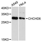 CHCHD6 Antibody - Western blot analysis of extracts of various cell lines, using CHCHD6 antibody at 1:3000 dilution. The secondary antibody used was an HRP Goat Anti-Rabbit IgG (H+L) at 1:10000 dilution. Lysates were loaded 25ug per lane and 3% nonfat dry milk in TBST was used for blocking. An ECL Kit was used for detection and the exposure time was 90s.