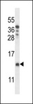 CHCHD8 Antibody - CHCH8 Antibody western blot of T47D cell line lysates (35 ug/lane). The CHCH8 antibody detected the CHCH8 protein (arrow).