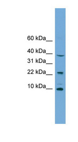 CHCHD8 Antibody - CHCHD8 antibody Western blot of Jurkat lysate. This image was taken for the unconjugated form of this product. Other forms have not been tested.