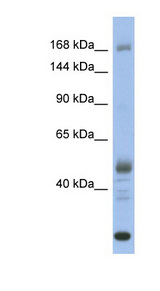 CHD1 Antibody - CHD1 antibody Western blot of Fetal Stomach lysate. This image was taken for the unconjugated form of this product. Other forms have not been tested.
