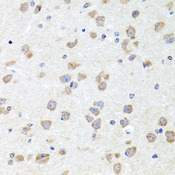 CHD1 Antibody - Immunohistochemistry of paraffin-embedded mouse brain tissue.