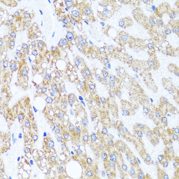 CHD1 Antibody - Immunohistochemistry of paraffin-embedded human liver injury tissue.