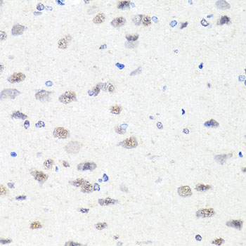 CHD1 Antibody - Immunohistochemistry of paraffin-embedded rat brain tissue.