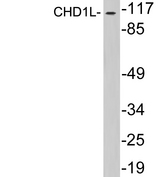 CHD1L Antibody - Western blot analysis of lysates from HepG2 cells, using CHD1L antibody.