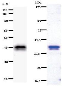 CHD1L Antibody - Western blot of immunized recombinant protein using CHD1L antibody. Left: CHD1L staining. Right: Coomassie Blue staining of immunized recombinant protein.