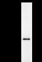 CHD1L Antibody - Immunoprecipitation: RIPA lysate of HeLa cells was incubated with anti-CHD1L mAb. Predicted molecular weight: 101 kDa
