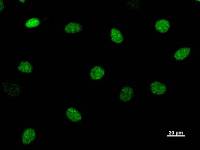 CHD1L Antibody - Immunostaining analysis in HeLa cells. HeLa cells were fixed with 4% paraformaldehyde and permeabilized with 0.1% Triton X-100 in PBS. The cells were immunostained with anti-CHD1L mAb.