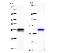 CHD1L Antibody - Left : Western blot analysis of immunized recombinant protein, using anti-CHD1L monoclonal antibody. Right : CBB staining of immunized recombinant protein.