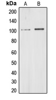 CHD1L Antibody - Western blot analysis of CHD1L expression in HeLa (A); HEK293T (B) whole cell lysates.