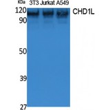 CHD1L Antibody - Western blot of CHD1L antibody