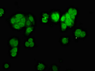CHD1L Antibody - Immunofluorescence staining of HepG2 cells at a dilution of 1:133, counter-stained with DAPI. The cells were fixed in 4% formaldehyde, permeabilized using 0.2% Triton X-100 and blocked in 10% normal Goat Serum. The cells were then incubated with the antibody overnight at 4 °C.The secondary antibody was Alexa Fluor 488-congugated AffiniPure Goat Anti-Rabbit IgG (H+L) .