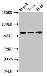 CHD1L Antibody - Positive Western Blot detected in HepG2 whole cell lysate, Hela whole cell lysate, A549 whole cell lysate. All lanes: CHD1L antibody at 3 µg/ml Secondary Goat polyclonal to rabbit IgG at 1/50000 dilution. Predicted band size: 101, 91, 78, 89, 70 KDa. Observed band size: 101 KDa
