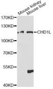 CHD1L Antibody - Western blot analysis of extracts of various cell lines, using CHD1L antibody at 1:1000 dilution. The secondary antibody used was an HRP Goat Anti-Rabbit IgG (H+L) at 1:10000 dilution. Lysates were loaded 25ug per lane and 3% nonfat dry milk in TBST was used for blocking. An ECL Kit was used for detection and the exposure time was 90s.