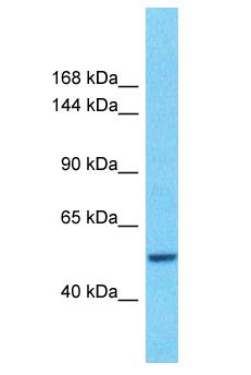 CHD2 Antibody - CHD2 antibody Western Blot of Ovary tumor. Antibody dilution: 1 ug/ml.  This image was taken for the unconjugated form of this product. Other forms have not been tested.
