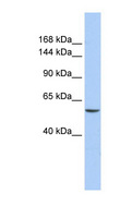 CHD2 Antibody - CHD2 antibody Western blot of 721_B cell lysate. This image was taken for the unconjugated form of this product. Other forms have not been tested.