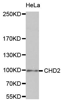 CHD2 Antibody - Western blot analysis of extracts of HeLa cell line, using CHD2 antibody.