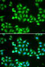 CHD2 Antibody - Immunofluorescence analysis of HeLa cells.