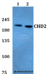 CHD2 Antibody - Western blot of CHD2 antibody at 1:500 dilution. Lane 1: HEK293T whole cell lysate. Lane 2: A549 whole cell lysate.