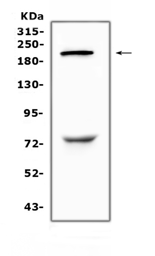 CHD2 Antibody - Western blot analysis of CHD2 using anti-CHD2 antibody. Electrophoresis was performed on a 5-20% SDS-PAGE gel at 70V (Stacking gel) / 90V (Resolving gel) for 2-3 hours. The sample well of each lane was loaded with 50ug of sample under reducing conditions. Lane 1: human HepG2 whole Cell lysate. After Electrophoresis, proteins were transferred to a Nitrocellulose membrane at 150mA for 50-90 minutes. Blocked the membrane with 5% Non-fat Milk/ TBS for 1.5 hour at RT. The membrane was incubated with rabbit anti-CHD2 antigen affinity purified polyclonal antibody at 0.5 µg/mL overnight at 4°C, then washed with TBS-0.1% Tween 3 times with 5 minutes each and probed with a goat anti-rabbit IgG-HRP secondary antibody at a dilution of 1:10000 for 1.5 hour at RT. The signal is developed using an Enhanced Chemiluminescent detection (ECL) kit with Tanon 5200 system. A specific band was detected for CHD2 at approximately 211KD. The expected band size for CHD2 is at 211KD.