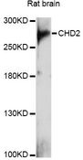 CHD2 Antibody - Western blot analysis of extracts of rat brain, using CHD2 antibody at 1:1000 dilution. The secondary antibody used was an HRP Goat Anti-Rabbit IgG (H+L) at 1:10000 dilution. Lysates were loaded 25ug per lane and 3% nonfat dry milk in TBST was used for blocking. An ECL Kit was used for detection and the exposure time was 90s.