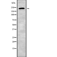 CHD2 Antibody - Western blot analysis of CHD2 using HT29 whole cells lysates