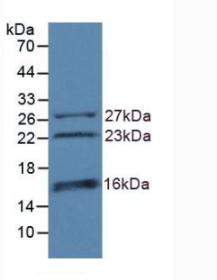 CHD3 Antibody - Western Blot; Sample: Recombinant CHD3, Human.