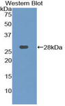 CHD3 Antibody - Western blot of recombinant CHD3.  This image was taken for the unconjugated form of this product. Other forms have not been tested.