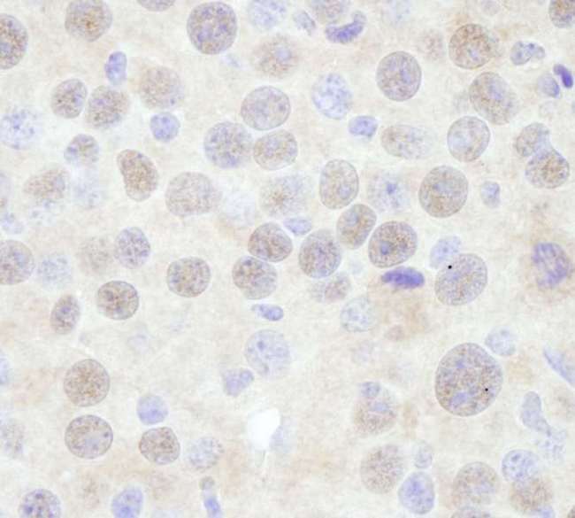 CHD3 Antibody - Detection of Mouse CHD3 by Immunohistochemistry. Sample: FFPE section of mouse renal cell carcinoma. Antibody: Affinity purified rabbit anti-CHD3 used at a dilution of 1:250.