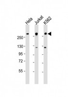 CHD3 Antibody - All lanes: Anti-CHD3 Antibody (N-Term) at 1:1000-1:2000 dilution. Lane 1: HeLa whole cell lysate. Lane 2: Jurkat whole cell lysate. Lane 3: K562 whole cell lysate Lysates/proteins at 20 ug per lane. Secondary Goat Anti-Rabbit IgG, (H+L), Peroxidase conjugated at 1:10000 dilution. Predicted band size: 227 kDa. Blocking/Dilution buffer: 5% NFDM/TBST.