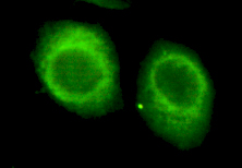 CHD3 Antibody - Immunocytochemistry of HeLa cells using anti- CHD3 (C-terminus) antibody diluted 1:150.