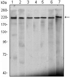 CHD3 Antibody - Western blot using CHD3 mouse monoclonal antibody against HeLa (1), K562 (2), Jurkat (3), NTERA-2 (4), HEK293 (5), Raji (6) cell lysate and mouse brain (7) tissue lysate.