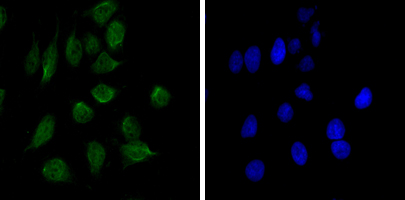 CHD3 Antibody - Immunofluorescence of HeLa cells using CHD3 mouse monoclonal antibody (green). Blue: DRAQ5 fluorescent DNA dye.