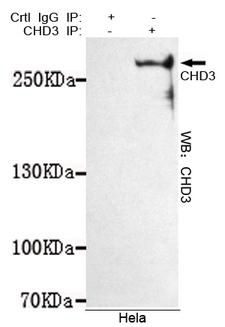 CHD3 Antibody - Immunoprecipitation analysis of HeLa cell lysates using CHD3 mouse monoclonal antibody.