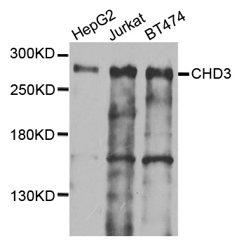 CHD3 Antibody - Western blot analysis of extracts of various cells.