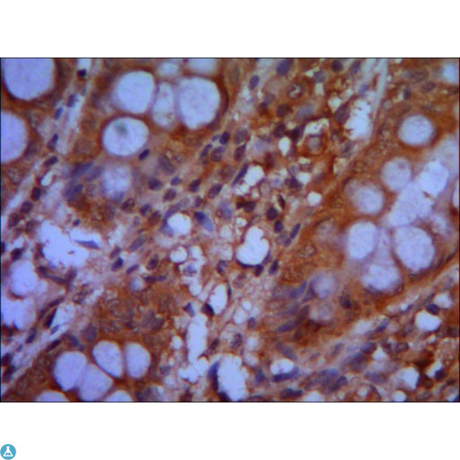 CHD3 Antibody - IHC of paraffin-embedded human colon using anti-CHD3 (C-term) diluted 1:500-1:1000.