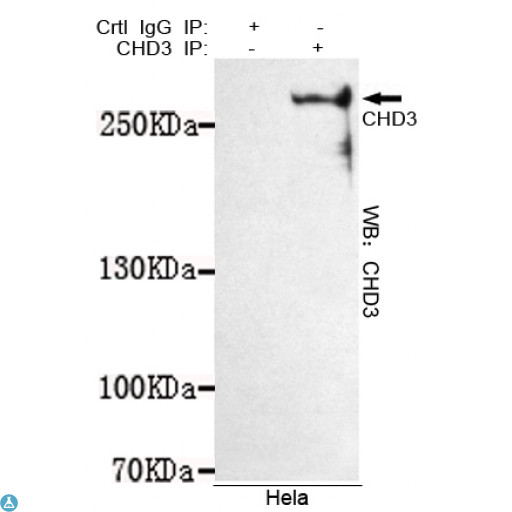 CHD3 Antibody - Immunoprecipitation analysis of Hela cell lysates using CHD3 mouse mAb.