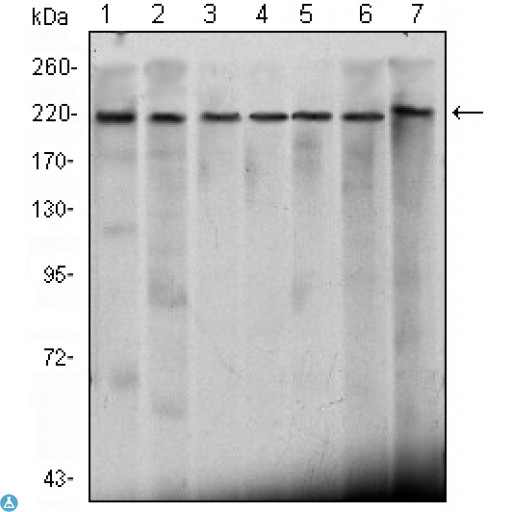 CHD3 Antibody - Western Blot (WB) analysis using Mi2-alpha Monoclonal Antibody against HeLa (1), K562 (2), Jurkat (3), NTERA-2 (4), HEK293 (5), Raji (6) cell lysate and Mouse Brain (7) tissue lysate.