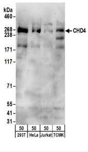 CHD4 Antibody - Detection of Human and Mouse CHD4 by Western Blot. Samples: Whole cell lysate (50 ug) from 293T, HeLa, Jurkat, and TCMK-1 cells. Antibodies: Affinity purified rabbit anti-CHD4 antibody used for WB at 0.1 ug/ml. Detection: Chemiluminescence with an exposure time of 30 seconds.