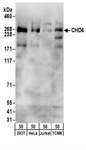CHD4 Antibody - Detection of Human and Mouse CHD4 by Western Blot. Samples: Whole cell lysate (50 ug) from 293T, HeLa, Jurkat, and TCMK-1 cells. Antibodies: Affinity purified rabbit anti-CHD4 antibody used for WB at 0.1 ug/ml. Detection: Chemiluminescence with an exposure time of 30 seconds.