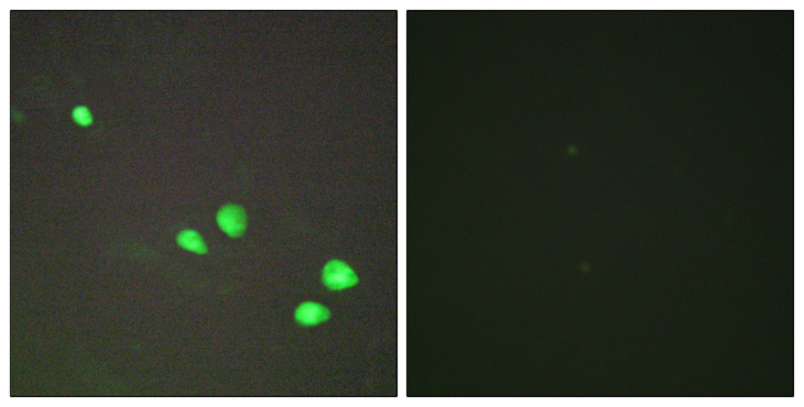 CHD4 Antibody - Immunofluorescence analysis of HepG2 cells, using CHD4 Antibody. The picture on the right is blocked with the synthesized peptide.