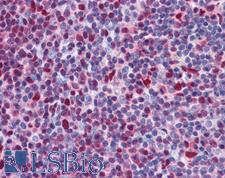 CHD4 Antibody - Anti-CHD4 antibody IHC of human tonsil. Immunohistochemistry of formalin-fixed, paraffin-embedded tissue after heat-induced antigen retrieval. Antibody concentration 5 ug/ml.  This image was taken for the unconjugated form of this product. Other forms have not been tested.