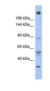 CHD4 Antibody - CHD4 antibody Western blot of OVCAR-3 cell lysate. This image was taken for the unconjugated form of this product. Other forms have not been tested.