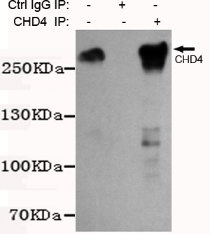 CHD4 Antibody - Immunoprecipitation analysis of K562 cell lysates using CHD4 mouse monoclonal antibody.