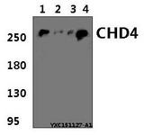 CHD4 Antibody - Western blot of CHD4 polyclonal antibody at 1:500 dilution. Lane 1: HeLa whole cell lysate (40 ug). Lane 2: NIH-3T3 whole cell lysate (40 ug). Lane 3: H9C2 whole cell lysate (40 ug). Lane 4: PC12 whole cell lysate (40 ug).