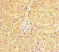 CHD4 Antibody - Immunohistochemistry of paraffin-embedded human liver tissue at dilution of 1:100