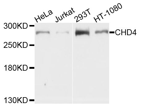 CHD4 Antibody - Western blot analysis of extracts of various cell lines, using CHD4 antibody at 1:1000 dilution. The secondary antibody used was an HRP Goat Anti-Rabbit IgG (H+L) at 1:10000 dilution. Lysates were loaded 25ug per lane and 3% nonfat dry milk in TBST was used for blocking. An ECL Kit was used for detection and the exposure time was 30s.