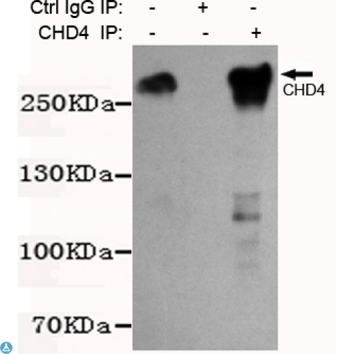 CHD4 Antibody - Immunoprecipitation analysis of K562 cell lysates using CHD4 mouse mAb.