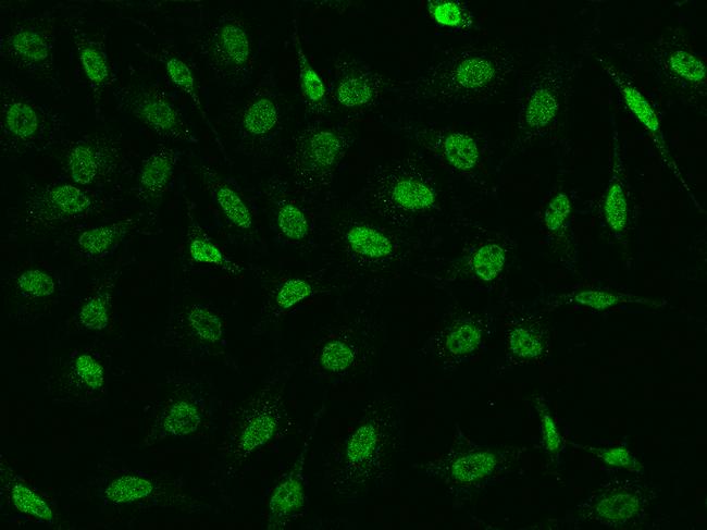 CHD4 Antibody - Immunofluorescence staining of CHD4 in HeLa cells. Cells were fixed with 4% PFA, permeabilzed with 0.1% Triton X-100 in PBS, blocked with 10% serum, and incubated with rabbit anti-Human CHD4 polyclonal antibody (dilution ratio 1:200) at 4°C overnight. Then cells were stained with the Alexa Fluor 488-conjugated Goat Anti-rabbit IgG secondary antibody (green). Positive staining was localized to Nucleus.