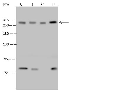 CHD4 Antibody - Anti-CHD4 rabbit polyclonal antibody at 1:500 dilution. Lane A: HeLa Whole Cell Lysate. Lane B: 293T Whole Cell Lysate. Lane C: NIH3T3 Whole Cell Lysate. Lane D: Jurkat Whole Cell Lysate. Lysates/proteins at 30 ug per lane. Secondary: Goat Anti-Rabbit IgG (H+L)/HRP at 1/10000 dilution. Developed using the ECL technique. Performed under reducing conditions. Predicted band size: 218 kDa.